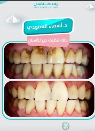 افضل مركز اسنان في جدة
